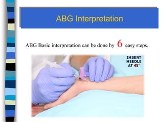 ABG Interpretation
ABG Basic interpretation can be done by 6 easy steps.
 
