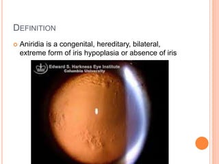 DEFINITION
 Aniridia is a congenital, hereditary, bilateral,
extreme form of iris hypoplasia or absence of iris
 