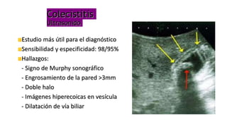 Colecistitis
Ultrasonido
Estudio más útil para el diagnóstico
Sensibilidad y especificidad: 98/95%
Hallazgos:
- Signo de Murphy sonográfico
- Engrosamiento de la pared >3mm
- Doble halo
- Imágenes hiperecoicas en vesícula
- Dilatación de vía biliar
 