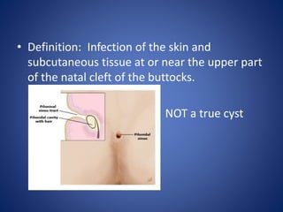 • Definition: Infection of the skin and
subcutaneous tissue at or near the upper part
of the natal cleft of the buttocks.
NOT a true cyst
 