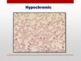 Hypochromic

 