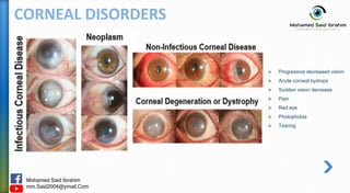 Mohamed Said Ibrahim
mm.Said2004@ymail.Com
CORNEAL DISORDERS
 Progressive decreased vision
 Acute corneal hydrops
 Sudden vision decrease
 Pain
 Red eye
 Photophobia
 Tearing
 