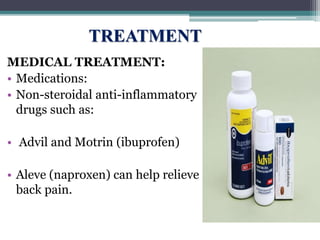 TREATMENT
MEDICAL TREATMENT:
• Medications:
• Non-steroidal anti-inflammatory
drugs such as:
• Advil and Motrin (ibuprofen)
• Aleve (naproxen) can help relieve
back pain.
 