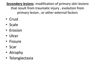 Secondary lesions: modification of primary skin lesions
that result from traumatic injury , evolution from
primary lesion , or other external factors
• Crust
• Scale
• Erosion
• Ulcer
• Fissure
• Scar
• Atrophy
• Telangiectasia
 