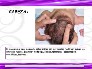 18
El cráneo suele estar moldeado; palpar cráneo con movimientos rotativos y suaves los
diferentes huesos. Examinar morfología, suturas, fontanelas, , descamación,
sensibilidad, lesiones.
CABEZA:
 