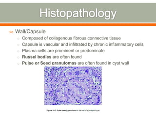  Wall/Capsule
o Composed of collagenous fibrous connective tissue
o Capsule is vascular and infiltrated by chronic inflammatory cells
o Plasma cells are prominent or predominate
o Russel bodies are often found
o Pulse or Seed granulomas are often found in cyst wall
 