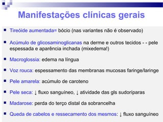 Manifestações clínicas gerais
 Tireóide aumentada= bócio (nas variantes não é observado)
 Acúmulo de glicosaminoglicanas na derme e outros tecidos - - pele
espessada e aparência inchada (mixedema!)
 Macroglossia: edema na língua
 Voz rouca: espessamento das membranas mucosas faringe/laringe
 Pele amarela: acúmulo de caroteno
 Pele seca: ↓ fluxo sanguíneo, ↓ atividade das gls sudoríparas
 Madarose: perda do terço distal da sobrancelha
 Queda de cabelos e ressecamento dos mesmos: ↓ fluxo sanguíneo
 