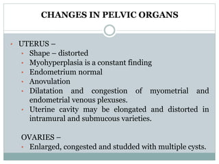 CHANGES IN PELVIC ORGANS
• UTERUS –
• Shape – distorted
• Myohyperplasia is a constant finding
• Endometrium normal
• Anovulation
• Dilatation and congestion of myometrial and
endometrial venous plexuses.
• Uterine cavity may be elongated and distorted in
intramural and submucous varieties.
OVARIES –
• Enlarged, congested and studded with multiple cysts.
 