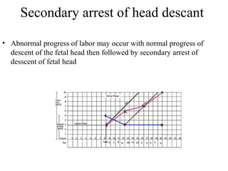 Secondary arrest of head descant
• Abnormal progress of labor may occur with normal progress of
descent of the fetal head then followed by secondary arrest of
desscent of fetal head
 
