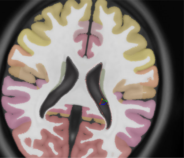 Scan of a brain slice.